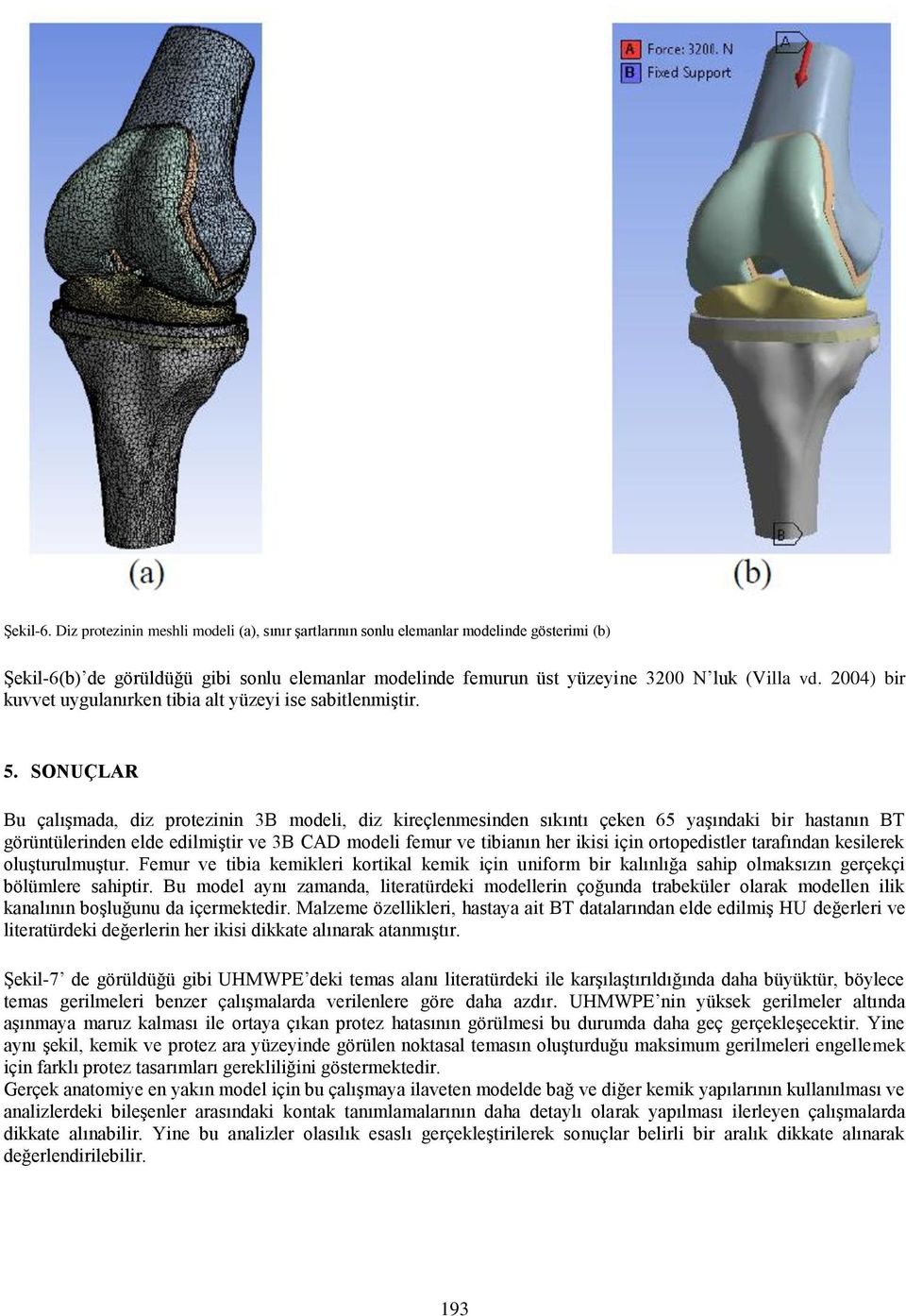 SONUÇLAR Bu çalışmada, diz protezinin 3B modeli, diz kireçlenmesinden sıkıntı çeken 65 yaşındaki bir hastanın BT görüntülerinden elde edilmiştir ve 3B CAD modeli femur ve tibianın her ikisi için
