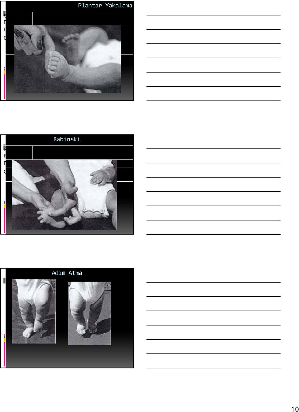 Babinski Stimulus / Response Duration Concern S: Stroke bottom or lateral portion of foot R: Great toe
