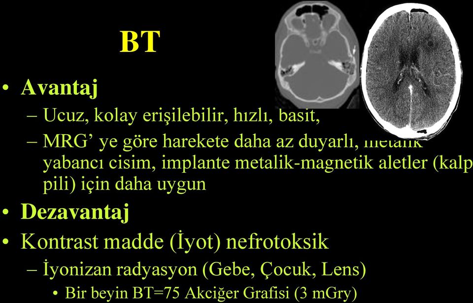 (kalp pili) için daha uygun Dezavantaj Kontrast madde (İyot) nefrotoksik