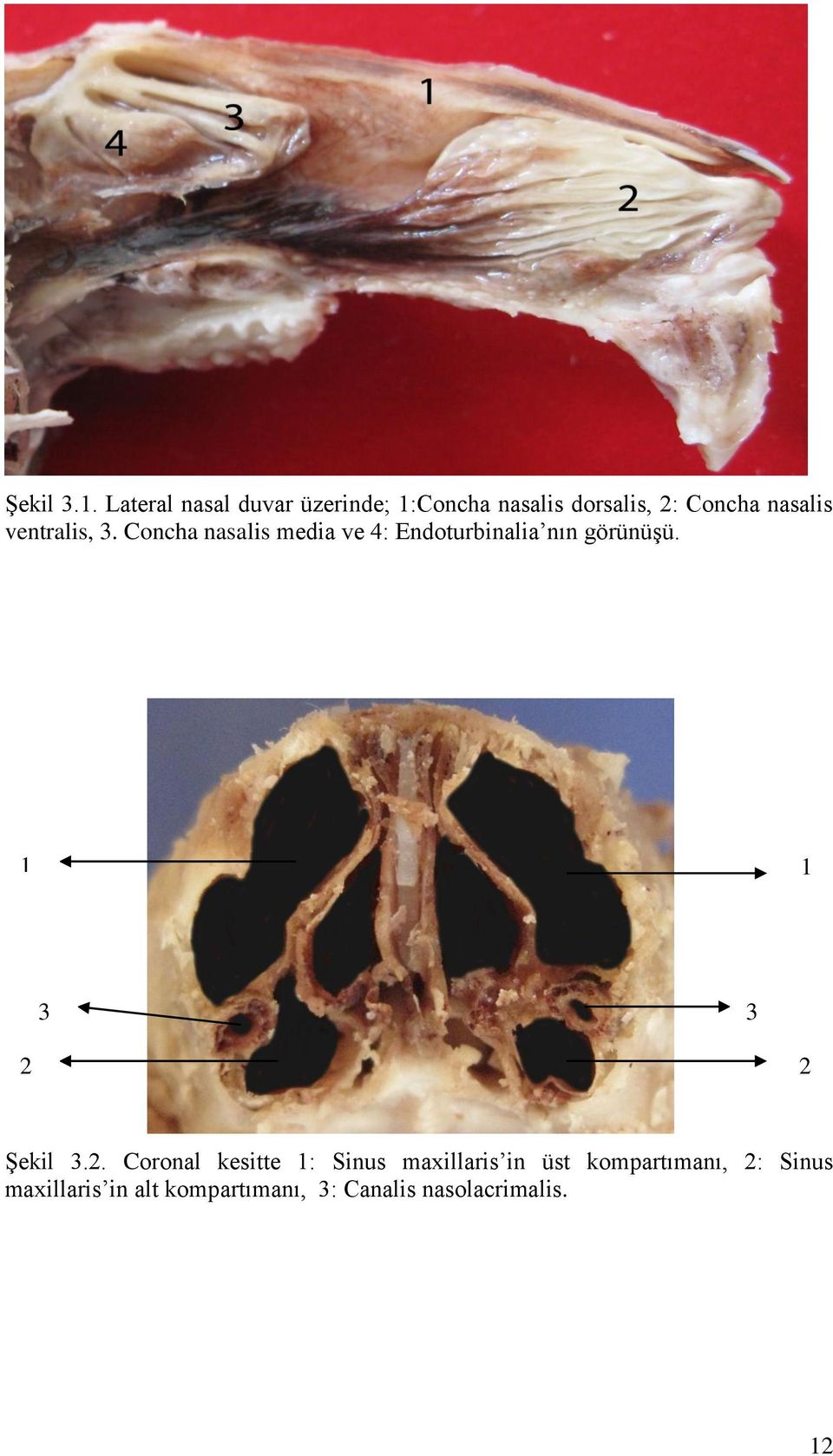 ventralis, 3. Concha nasalis media ve 4: Endoturbinalia nın görünüģü.