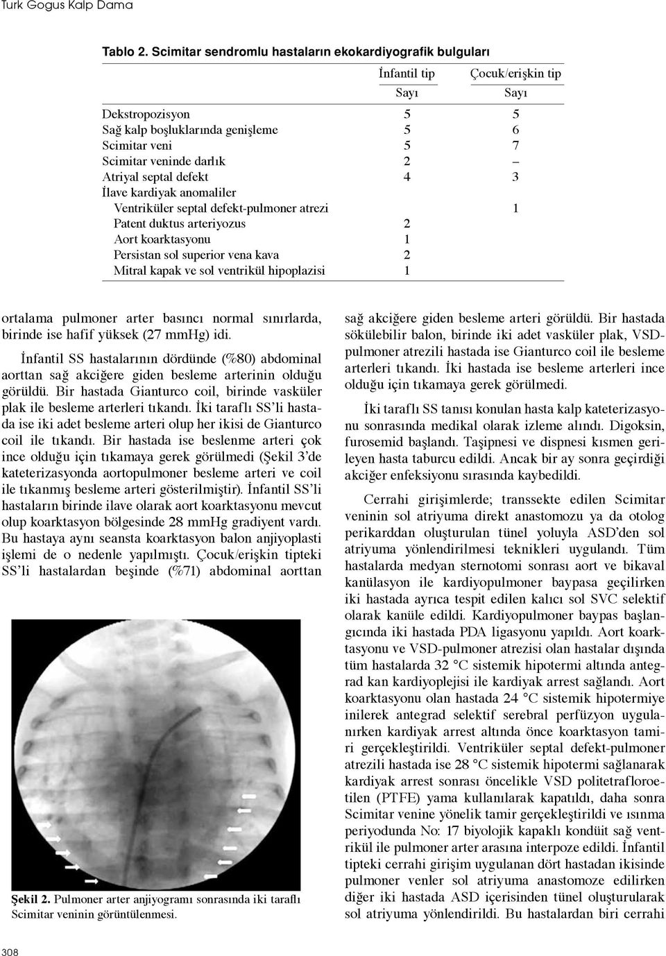 Atriyal septal defekt 4 3 İlave kardiyak anomaliler Ventriküler septal defekt-pulmoner atrezi 1 Patent duktus arteriyozus 2 Aort koarktasyonu 1 Persistan sol superior vena kava 2 Mitral kapak ve sol