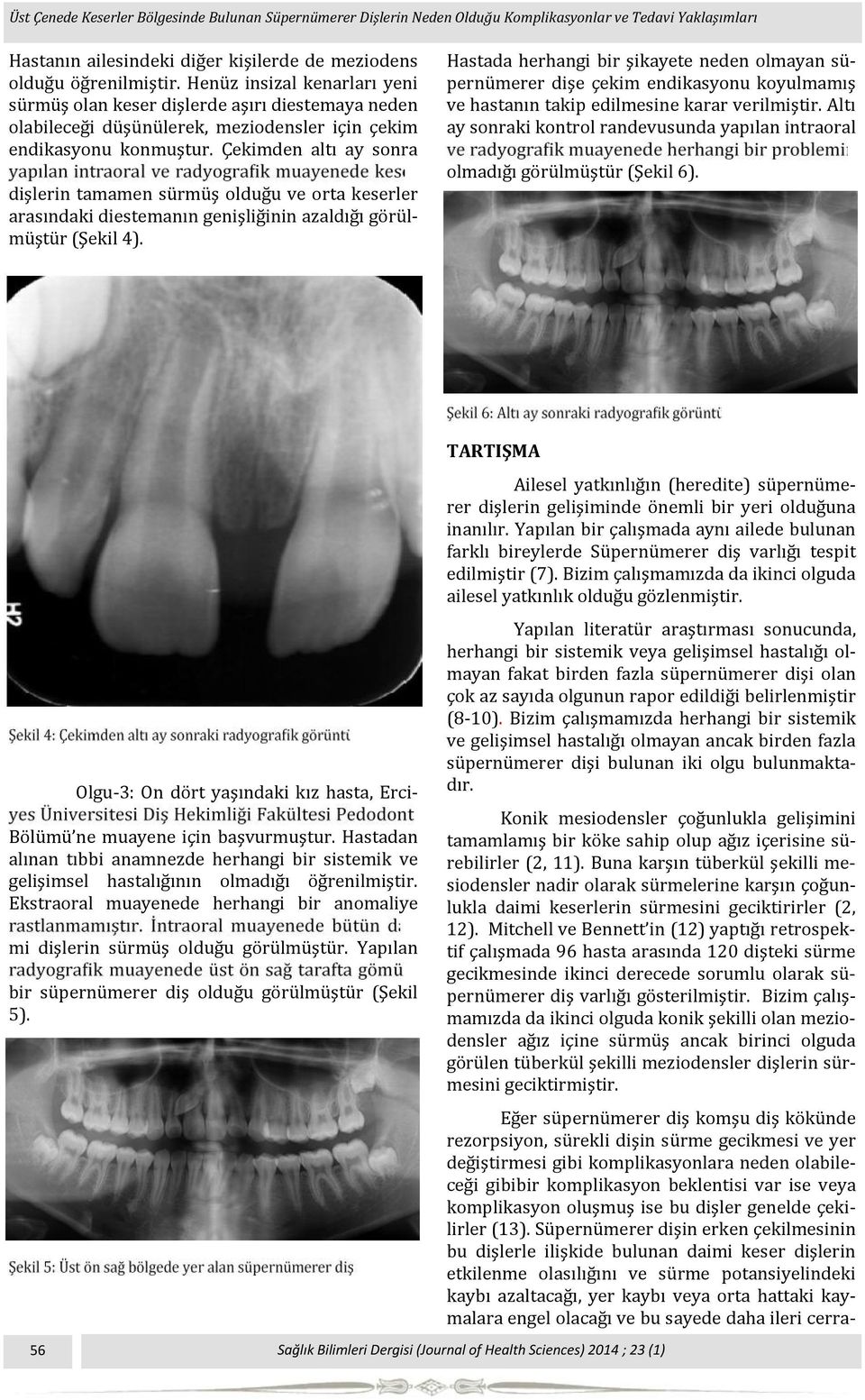 Çekimden altı ay sonra dişlerin tamamen su rmu ş oldug u ve orta keserler arasındaki diestemanın genişlig inin azaldıg ı go ru l- mu ştu r (Şekil 4).