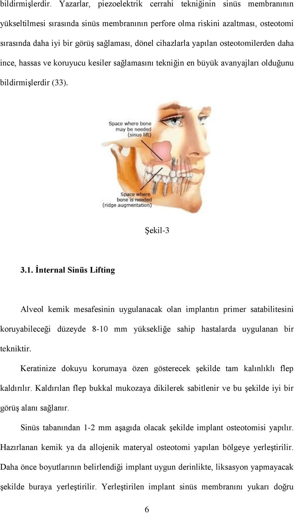 cihazlarla yapılan osteotomilerden daha ince, hassas ve koruyucu kesiler sağlamasını tekniğin en büyük avanyajları olduğunu bildirmişlerdir (33). Şekil-3 3.1.