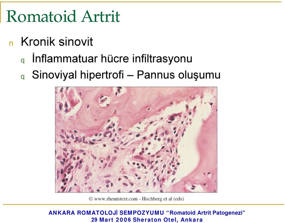 hücre infiltrasyonu q