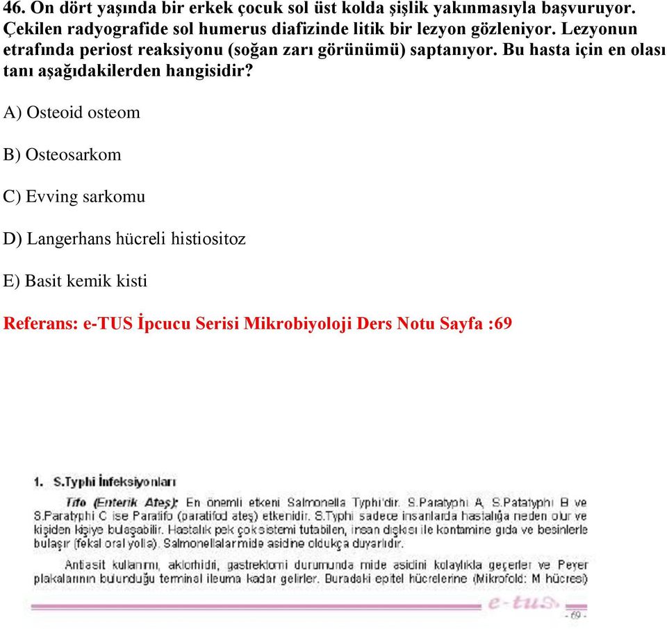 Lezyonun etrafında periost reaksiyonu (soğan zarı görünümü) saptanıyor.