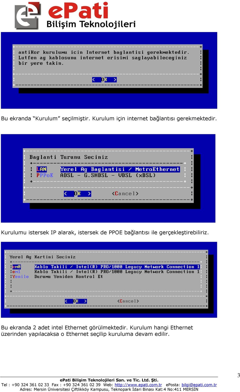 Kurulumu istersek IP alarak, istersek de PPOE bağlantısı ile