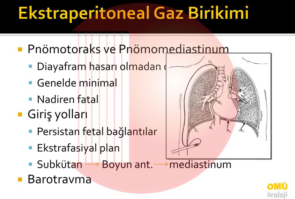 Giriş yolları Persistan fetal bağlantılar