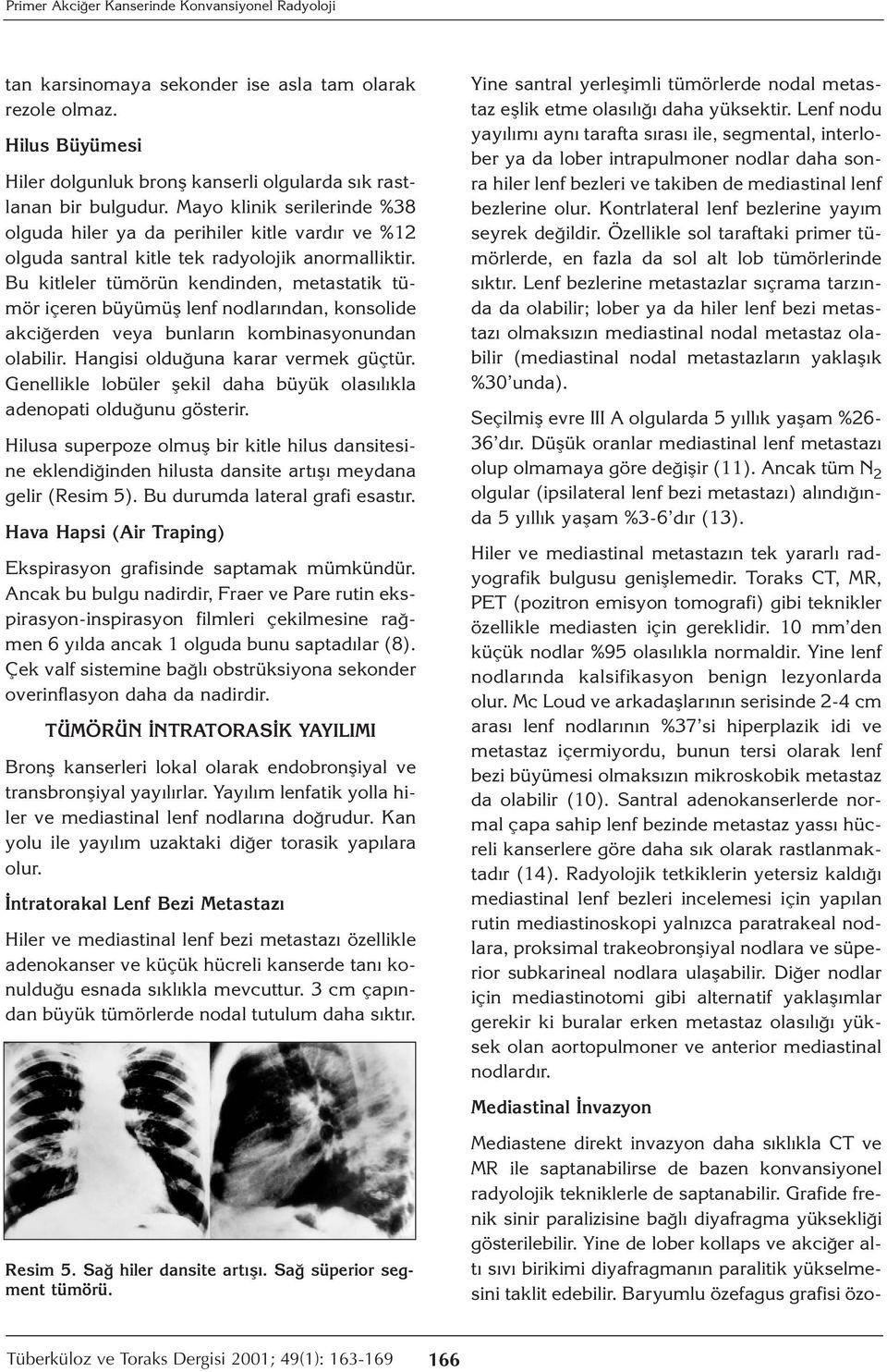 Bu kitleler tümörün kendinden, metastatik tümör içeren büyümüş lenf nodlarından, konsolide akciğerden veya bunların kombinasyonundan olabilir. Hangisi olduğuna karar vermek güçtür.