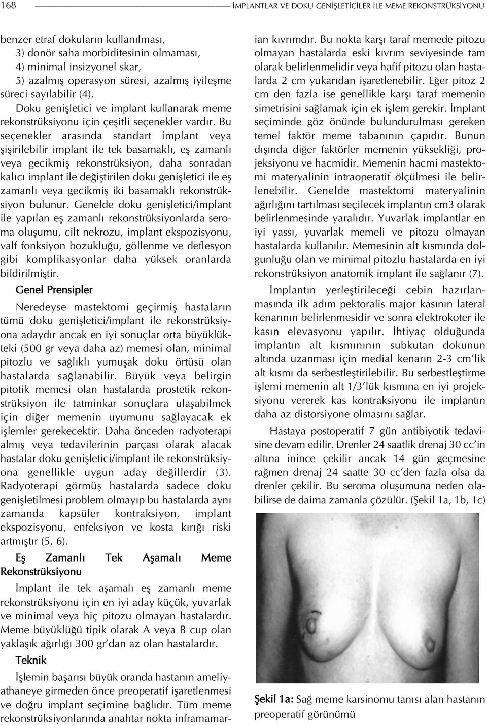 Bu seçenekler arasında standart implant veya şişirilebilir implant ile tek basamaklı, eş zamanlı veya gecikmiş rekonstrüksiyon, daha sonradan kalıcı implant ile değiştirilen doku genişletici ile eş