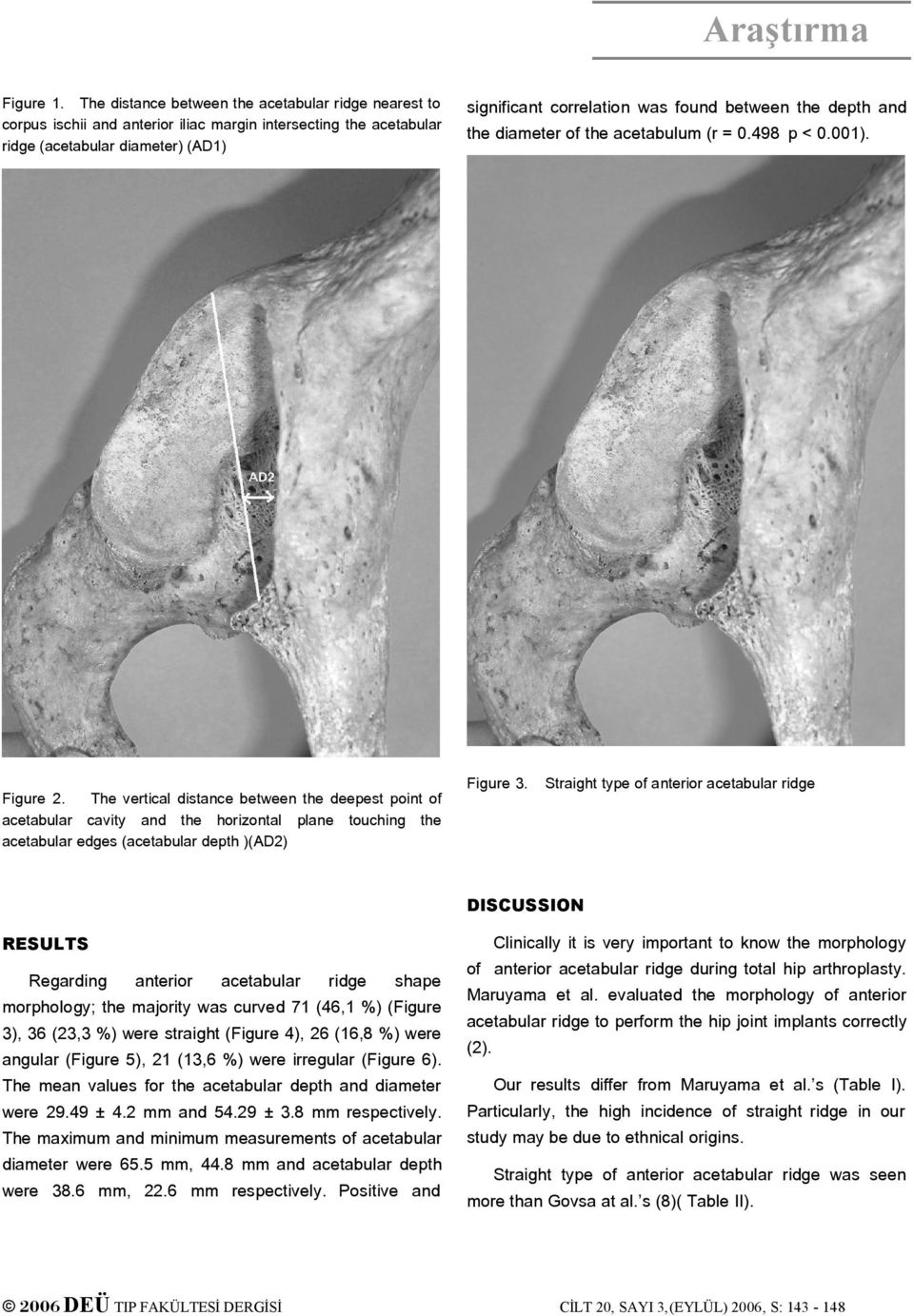 diameter of the acetabulum (r = 0.498 p < 0.001). Figure 3.