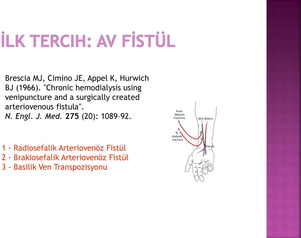 arteriovenous fistula". N. Engl. J. Med. 275 (20): 1089 92.