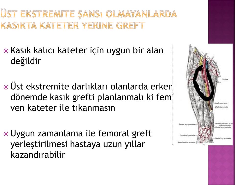 planlanmalı ki femoral ven kateter ile tıkanmasın Uygun