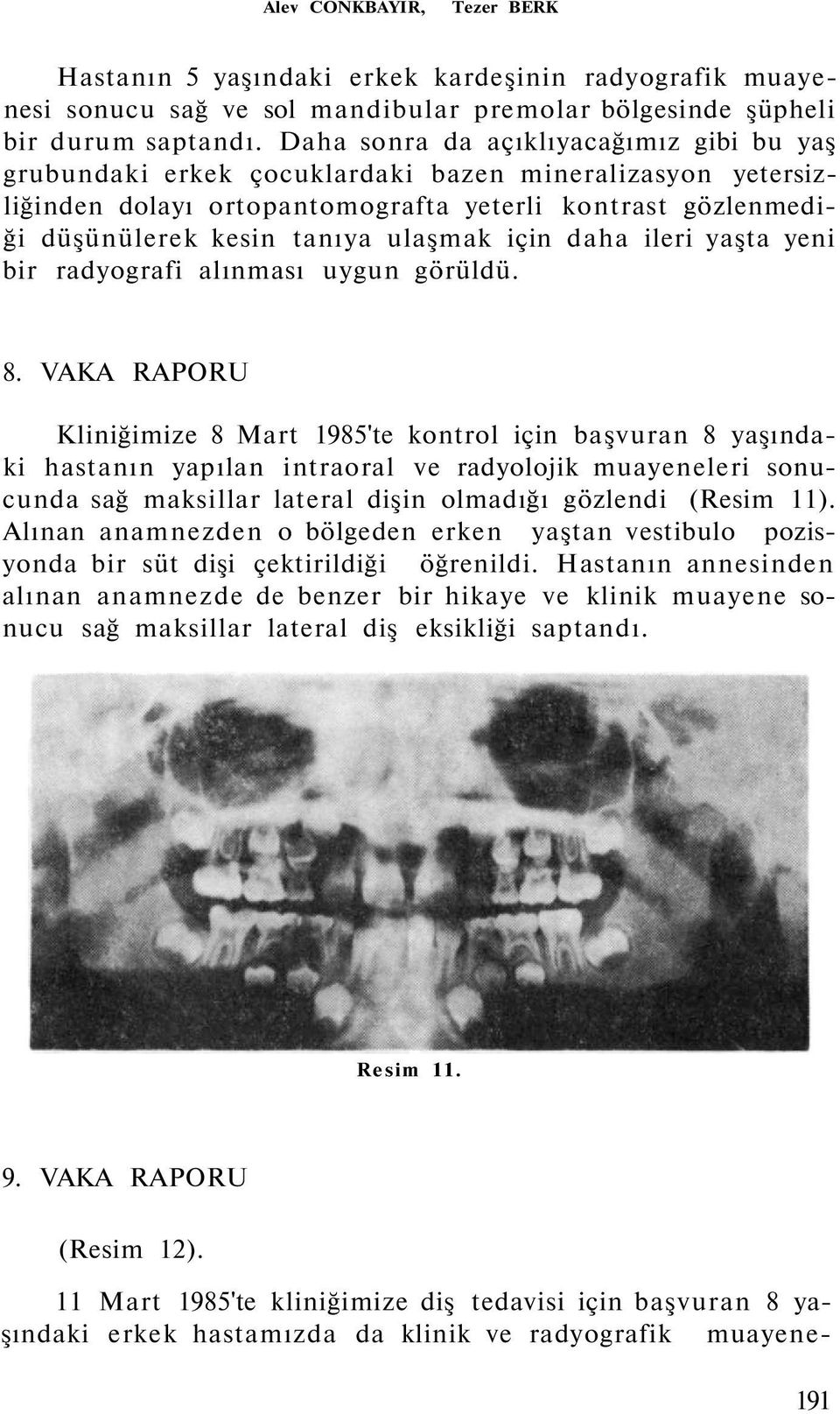 için daha ileri yaşta yeni bir radyografi alınması uygun görüldü. 8.