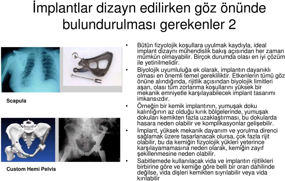 Etkenlerin tümü göz önüne alındığında, rijitlik açısından biyolojik limitleri aşan, olası tüm zorlanma koşullarını yüksek bir mekanik emniyetle karşılayabilecek implant tasarımı imkansızdır.