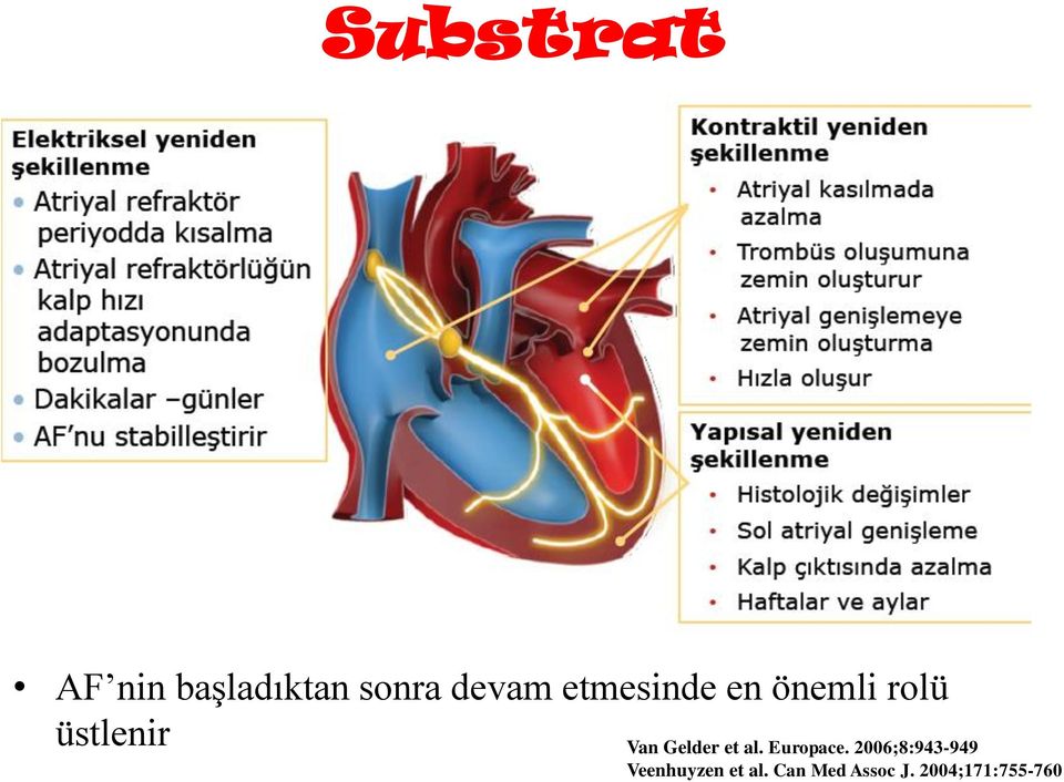 Gelder et al. Europace.