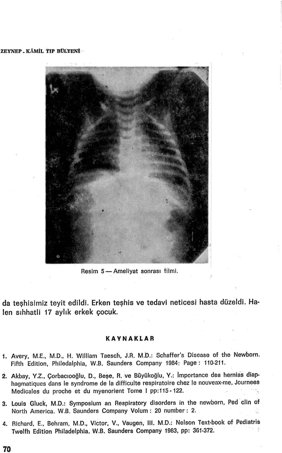 ve Büyükoğlu, V.: lmportance des hernias diaphagmatiques dans le syndrome de la difficulte respiratoire chez le nouveax-me, Journees Medicales du proche et du myenorient Tome 1 pp:115 ~ 122. 3.