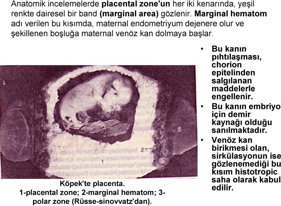 Köpek'te placenta. 1-placental zone; 2-marginal hematom; 3- polar zone (Rüsse-sinovvatz'dan).