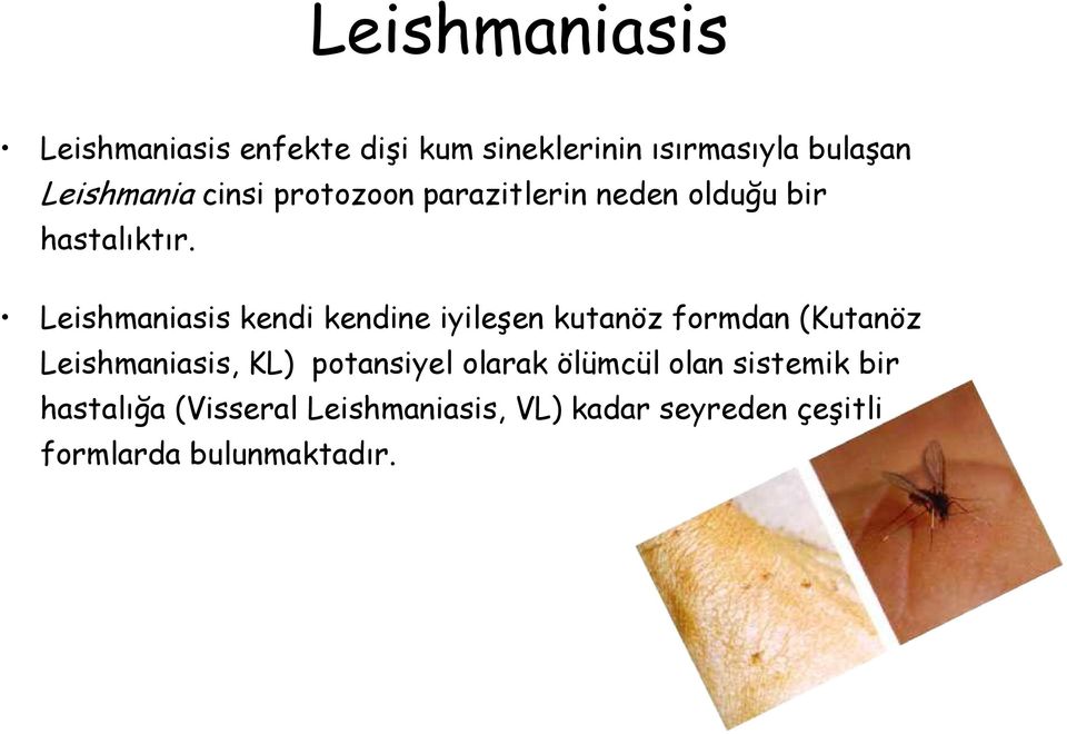 Leishmaniasis kendi kendine iyileşen kutanöz formdan (Kutanöz Leishmaniasis, KL)