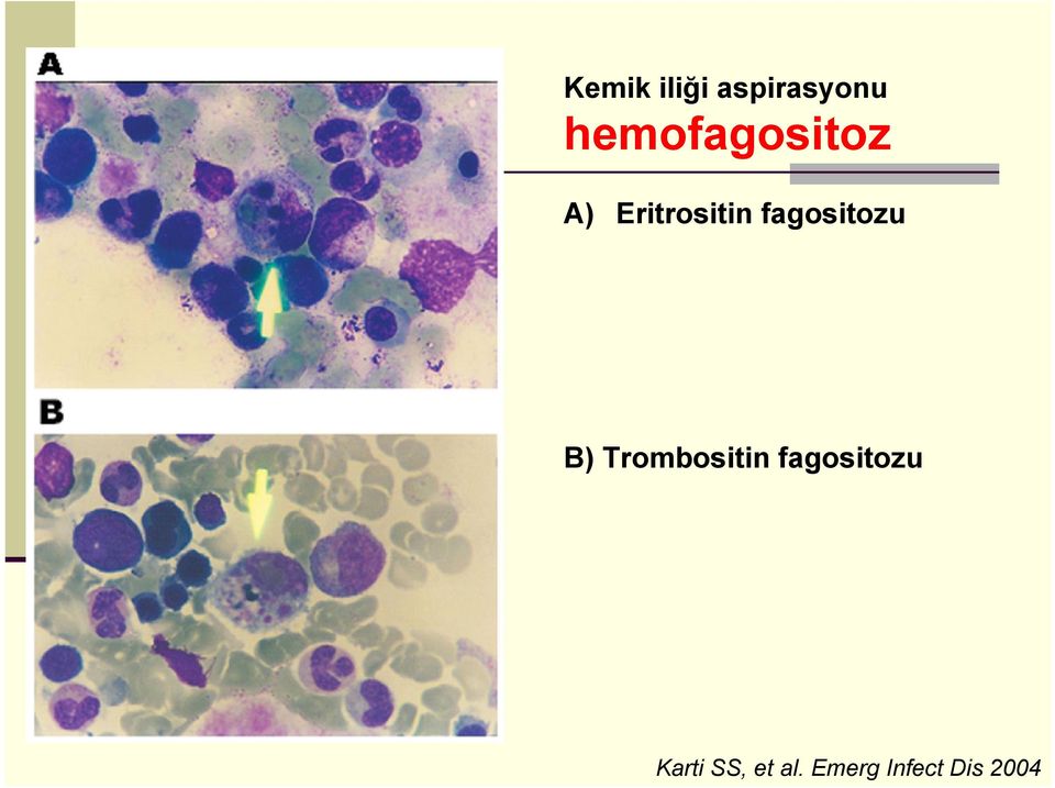 fagositozu B) Trombositin