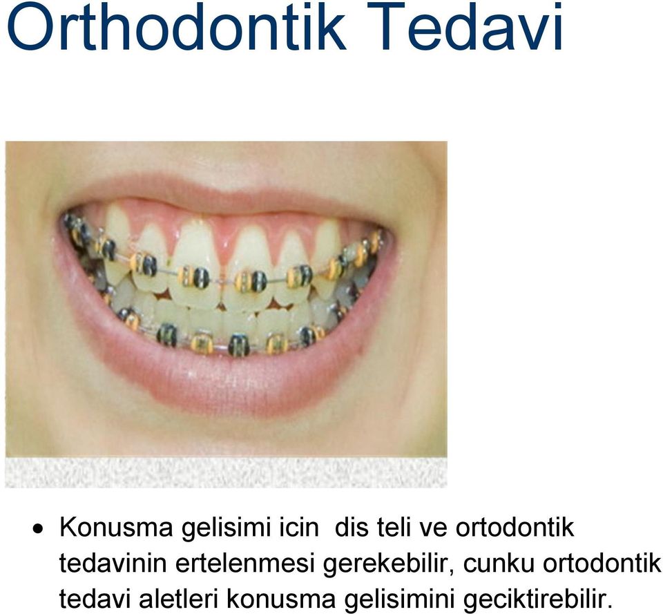 ertelenmesi gerekebilir, cunku ortodontik