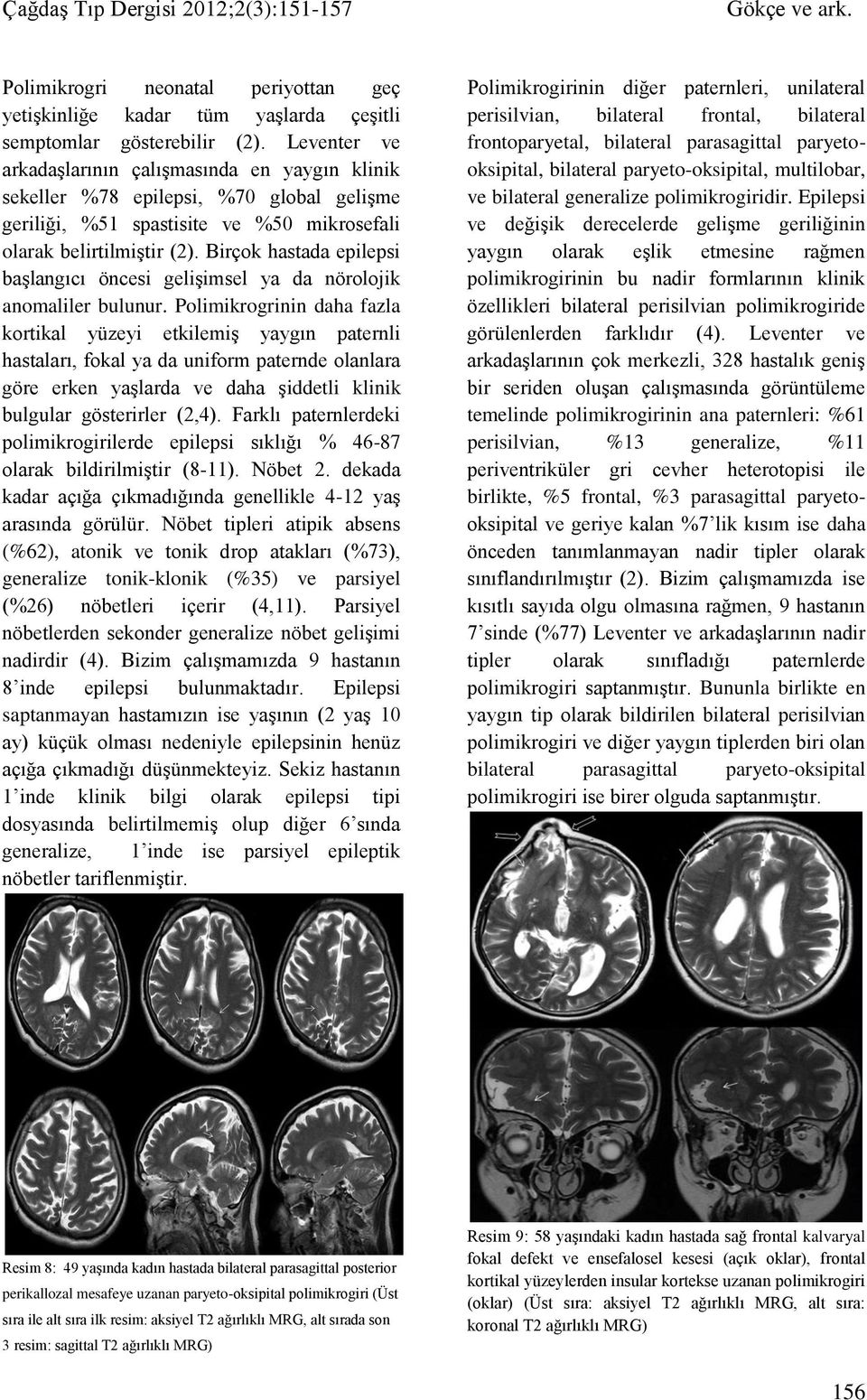 Birçok hastada epilepsi başlangıcı öncesi gelişimsel ya da nörolojik anomaliler bulunur.