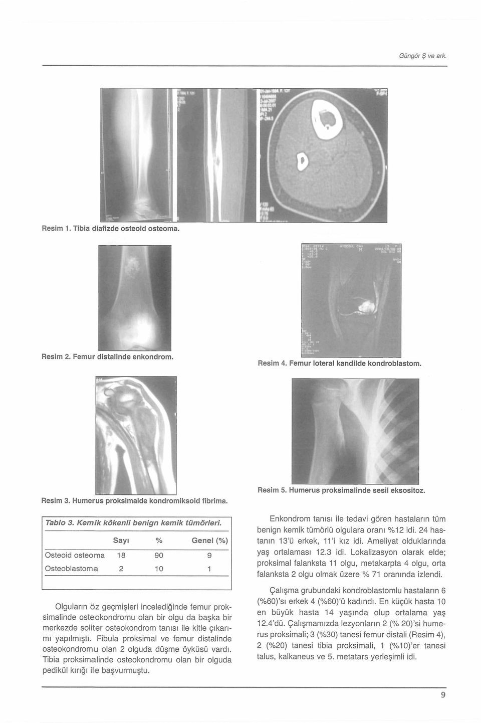 Sayı % Genel (%) O steoid o s te o m a 18 90 9 O ste o b la s to m a 2 10 1 Olguların öz geçmişleri incelediğinde femur proksimalinde osteokondromu olan bir olgu da başka bir merkezde soliter