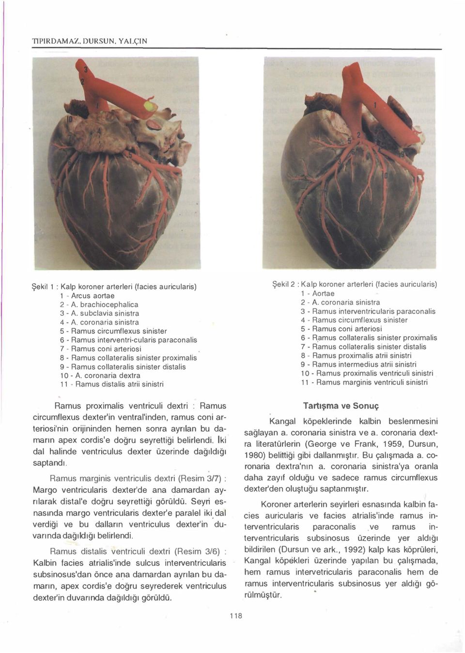 distalis ı O - A. coronaria dextra ı 1 - Ramus distalis atrii sinistri Şekil2 : Kalp koroner arterleri (facies auricularis) 1 - Aortae 2 - A.