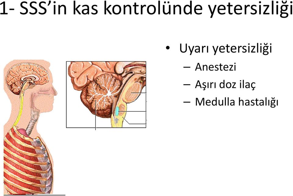 Uyarı yetersizliği