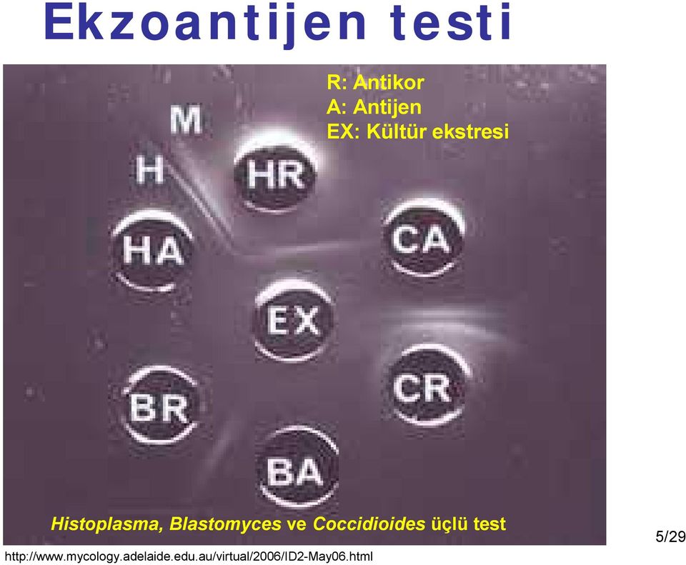Coccidioides üçlü test http://www.mycology.