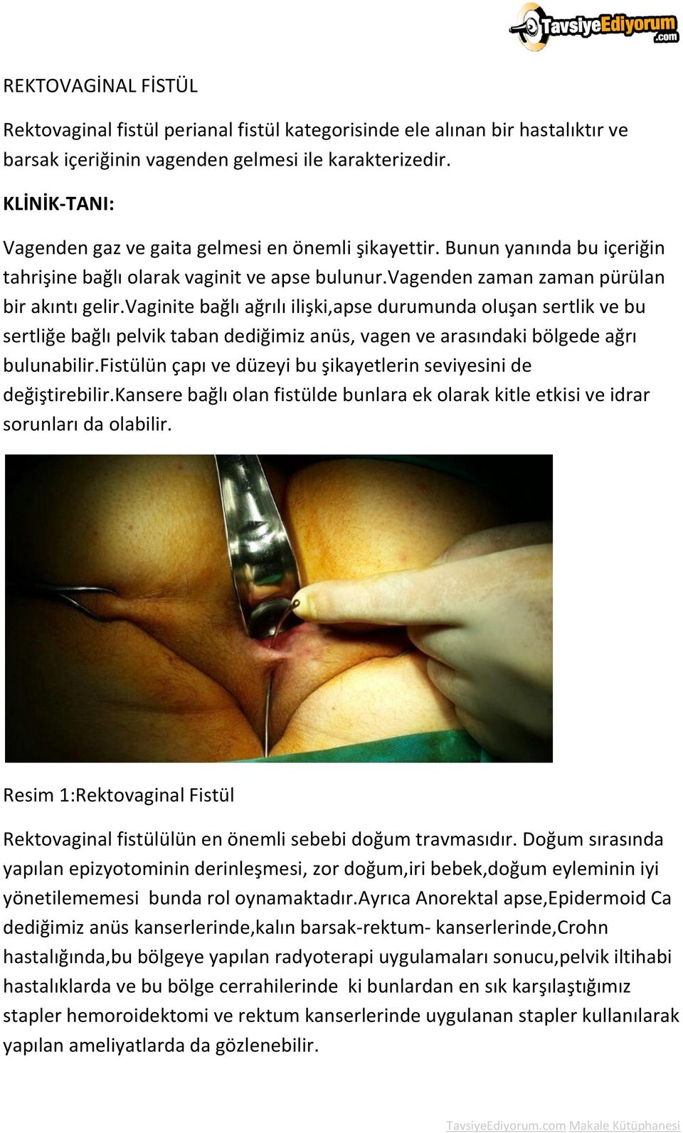 vaginite bağlı ağrılı ilişki,apse durumunda oluşan sertlik ve bu sertliğe bağlı pelvik taban dediğimiz anüs, vagen ve arasındaki bölgede ağrı bulunabilir.