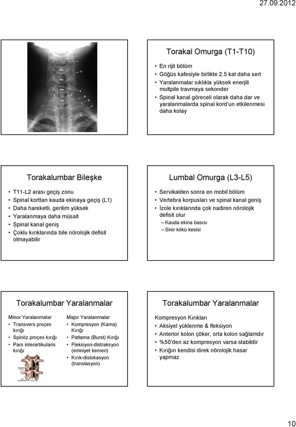 T11-L2 arası geçiş zonu Spinal korttan kauda ekinaya geçiş (L1) Daha hareketli, gerilim yüksek Yaralanmaya daha müsait Spinal kanal geniş Çoklu kırıklarında bile nörolojik defisit olmayabilir Lumbal