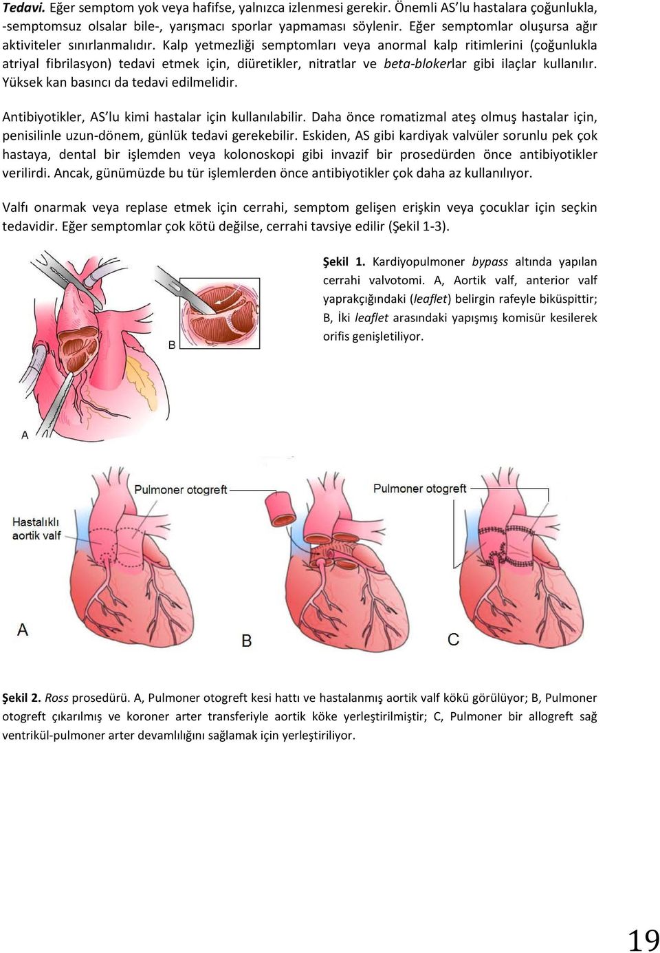 Kalp yetmezliği semptomları veya anormal kalp ritimlerini (çoğunlukla atriyal fibrilasyon) tedavi etmek için, diüretikler, nitratlar ve beta-blokerlar gibi ilaçlar kullanılır.