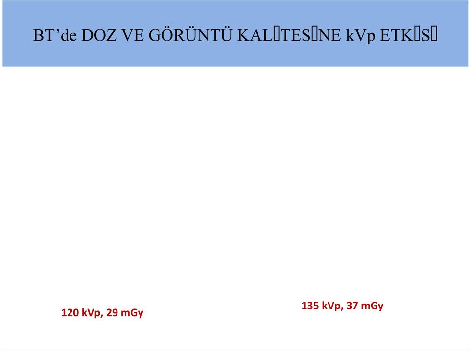 kvp ETKİSİ 120