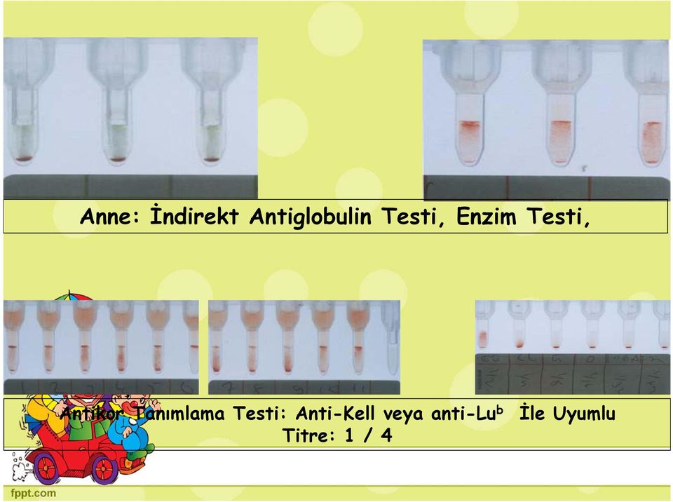 Tanımlama Testi: Anti-Kell