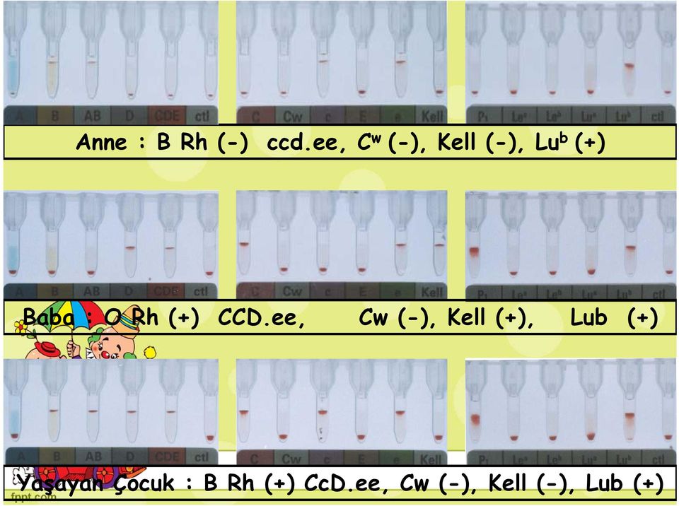 O Rh (+) CCD.