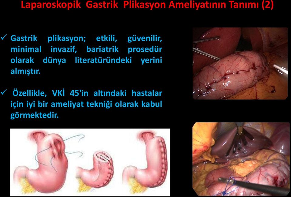 olarak dünya literatüründeki yerini almıştır.