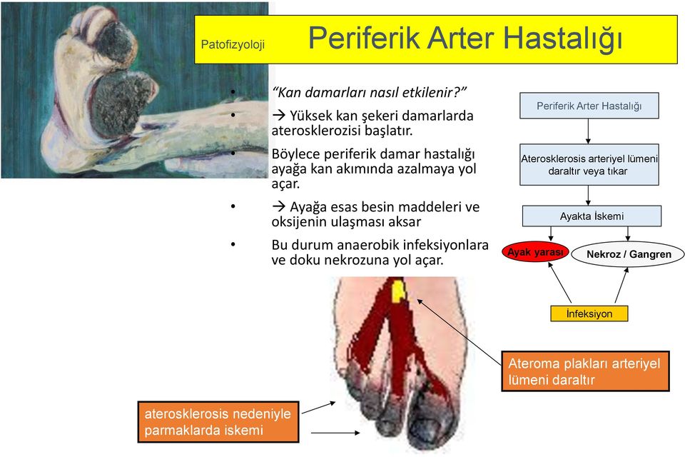 Ayağa esas besin maddeleri ve oksijenin ulaşması aksar Bu durum anaerobik infeksiyonlara ve doku nekrozuna yol açar.