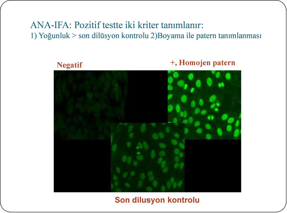 kontrolu 2)Boyama ile patern