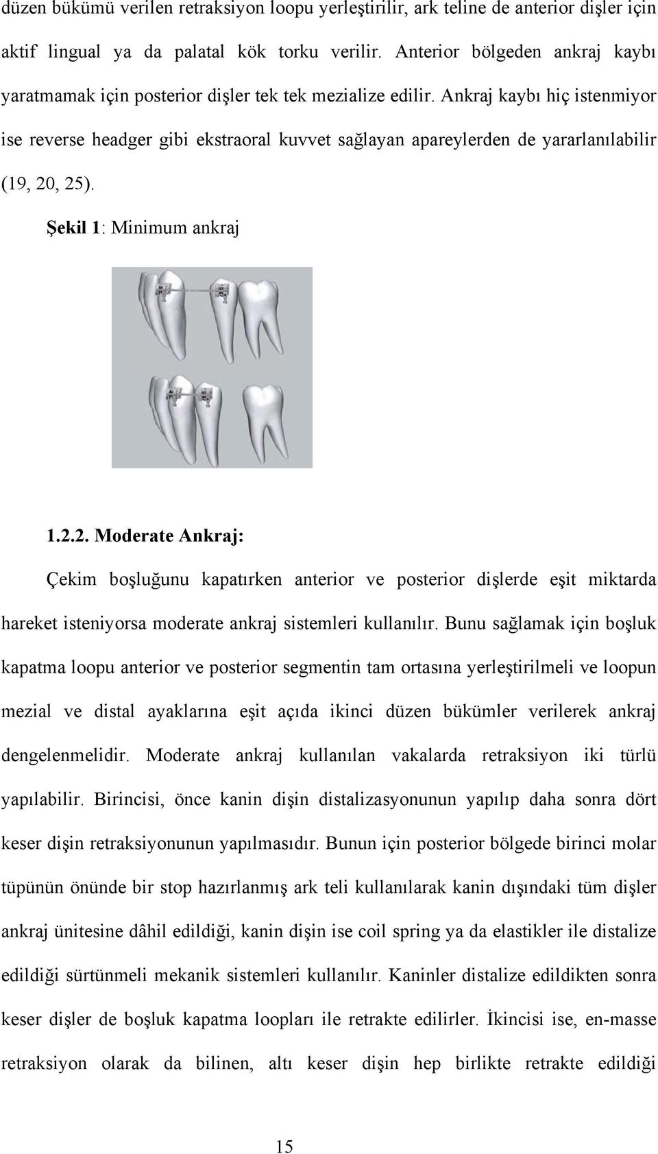 Ankraj kaybı hiç istenmiyor ise reverse headger gibi ekstraoral kuvvet sağlayan apareylerden de yararlanılabilir (19, 20