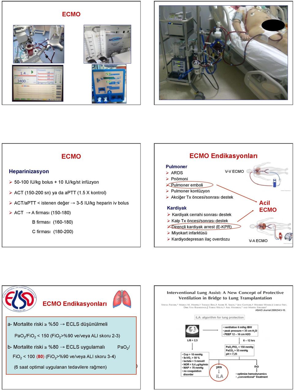 kontüzyon Ø Akciğer Tx si/sı destek Kardiyak Ø Kardiyak cerrahi sı destek Ø Kalp Tx si/sı destek Ø Dirençli kardiyak arrest (E-KPR) Ø Miyokart infarktüsü Ø Kardiyodepresan ilaç overdozu Acil V-A