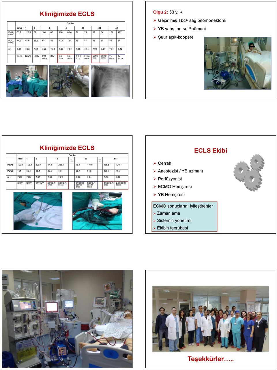 ILA 2. ILA Tx Tx Kliniğimizde ECLS Günler Yatış 1 2 9.. 29...... PaO2 102.1 105.4 129.1 97.3 226.1 76.1 116.6 165.5 120.7 PCO2 104 80.4 68.4 82.5 49.1 68.4 81.8 105.7 48.7 ph 7.20 7.26 7.37 7.36 7.