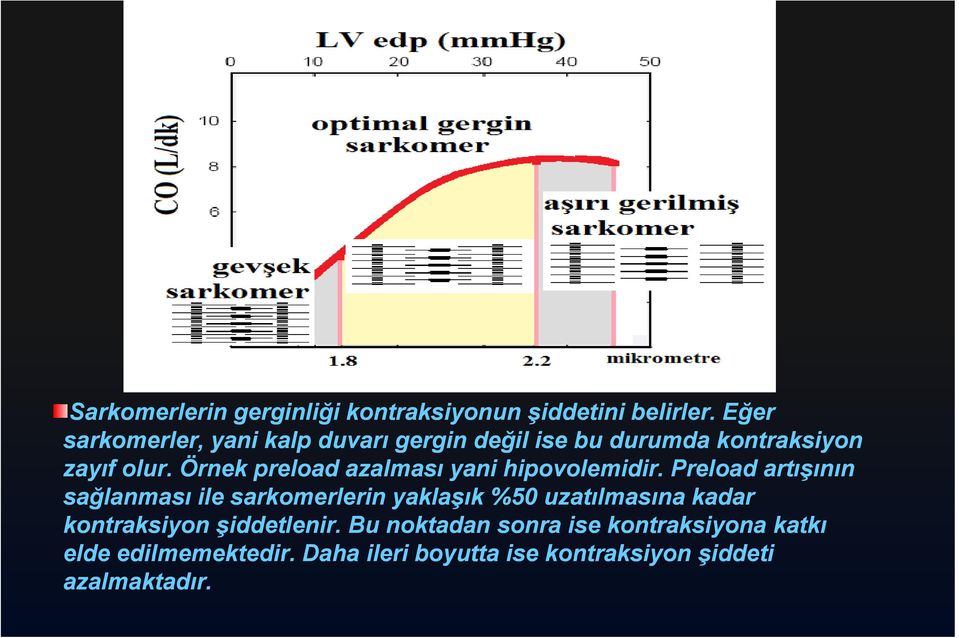 Örnek preload azalması yani hipovolemidir.