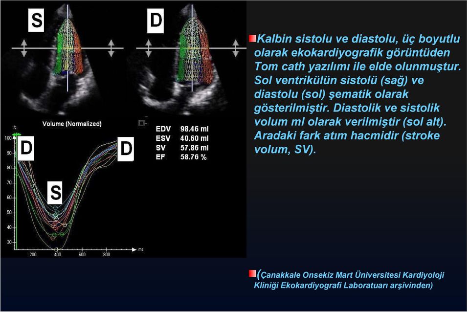 Diastolik ve sistolik volum ml olarak verilmiştir (sol alt).