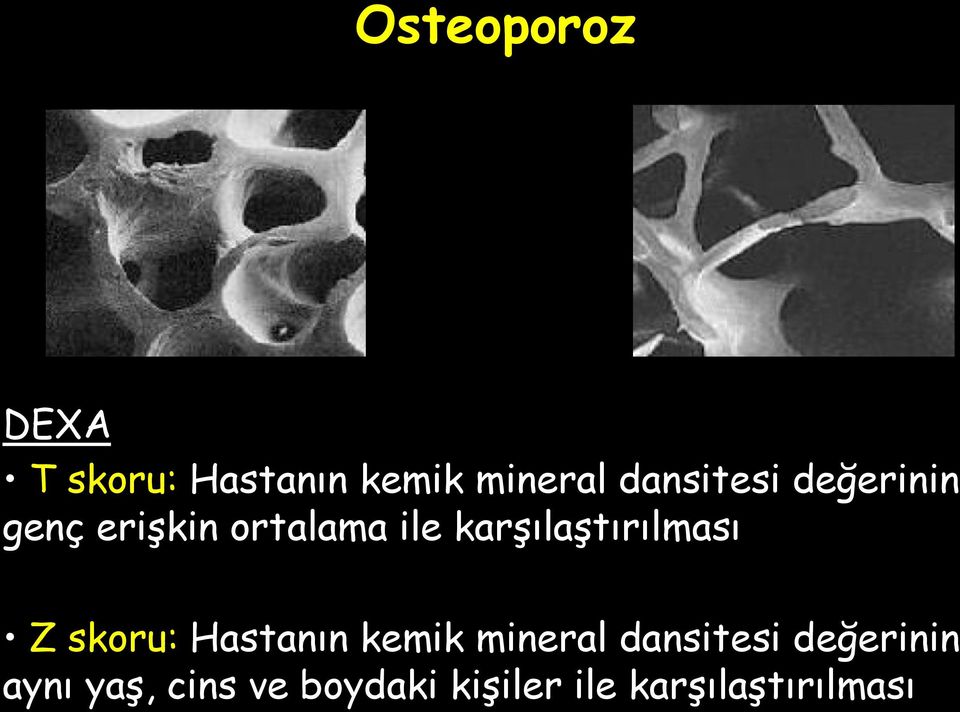 karşılaştırılması Z skoru: Hastanın kemik mineral