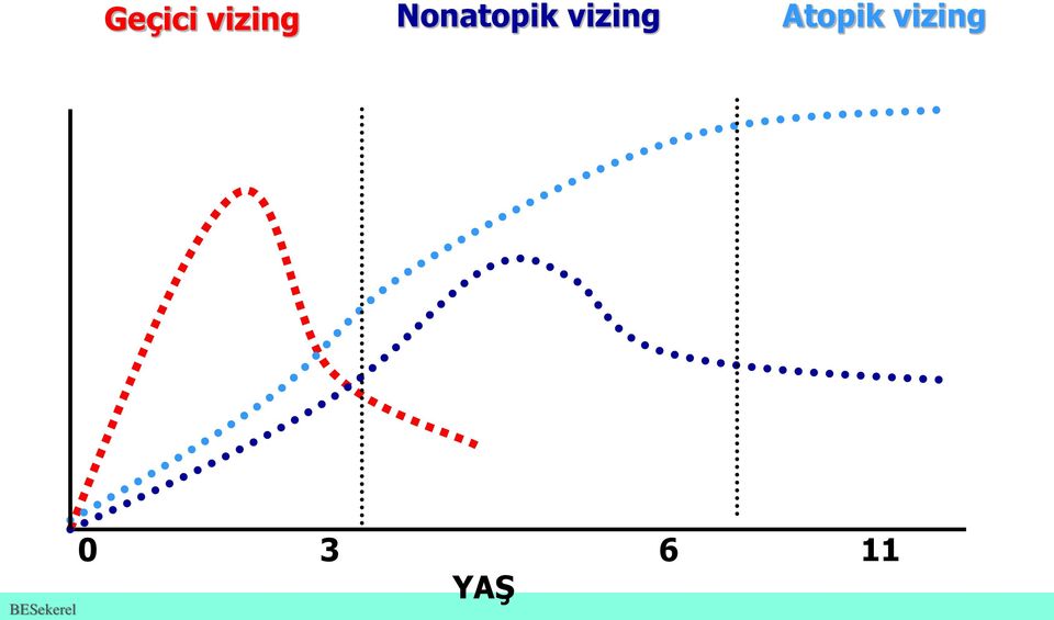 Atopik vizing