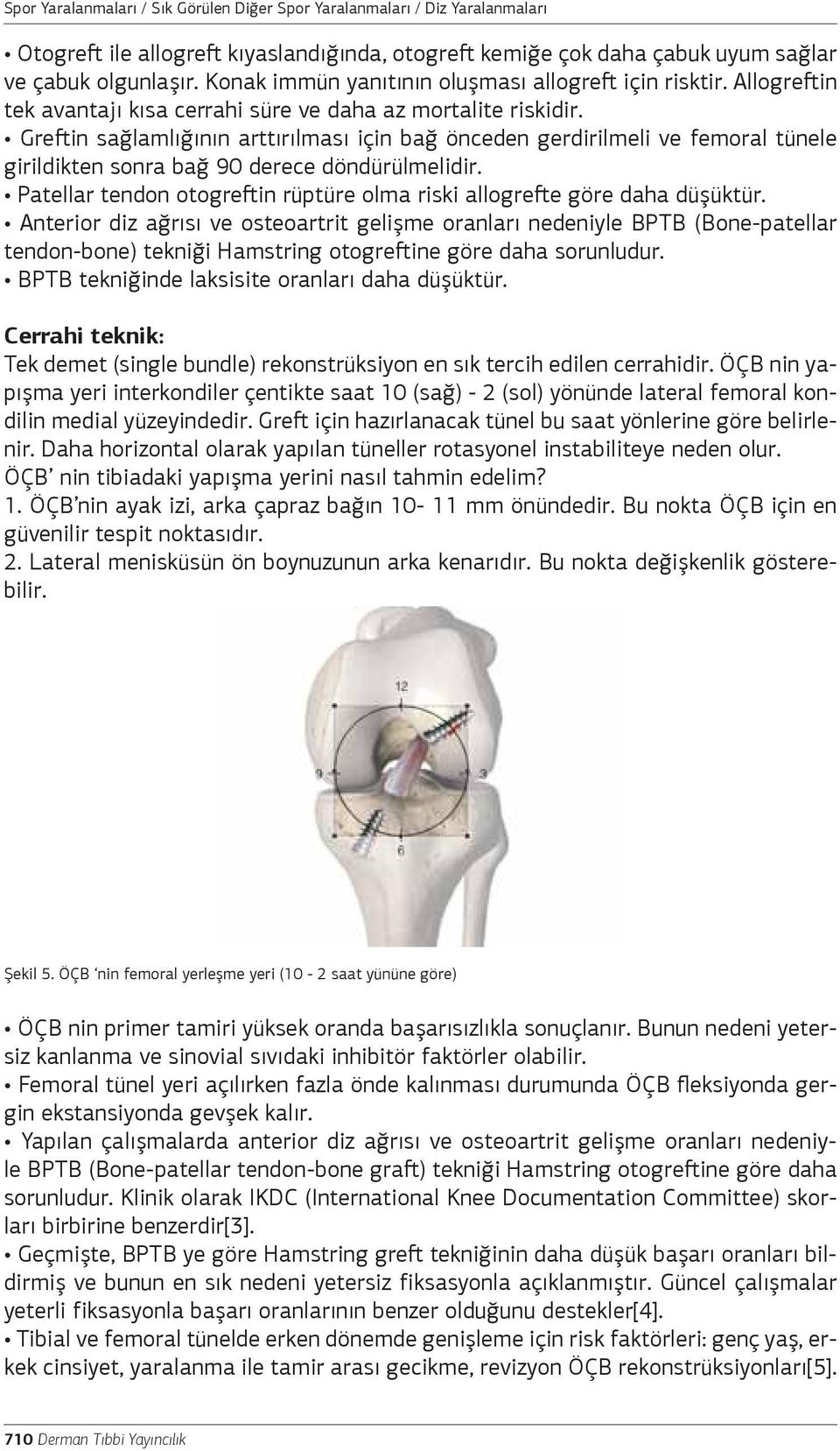 Greftin sağlamlığının arttırılması için bağ önceden gerdirilmeli ve femoral tünele girildikten sonra bağ 90 derece döndürülmelidir.