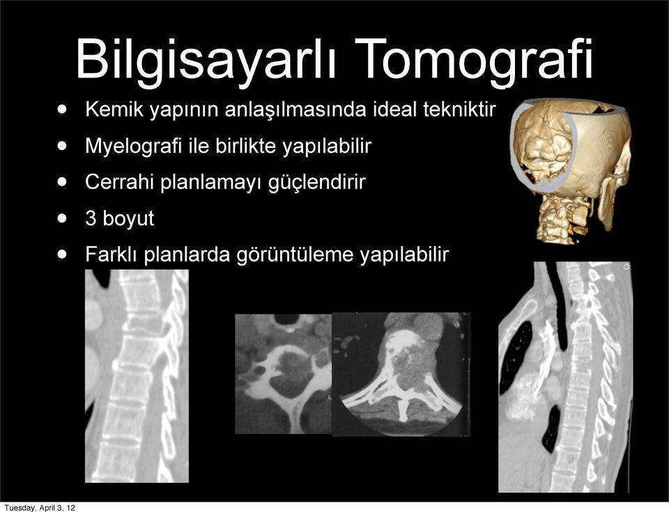 birlikte yapılabilir Cerrahi planlamayı