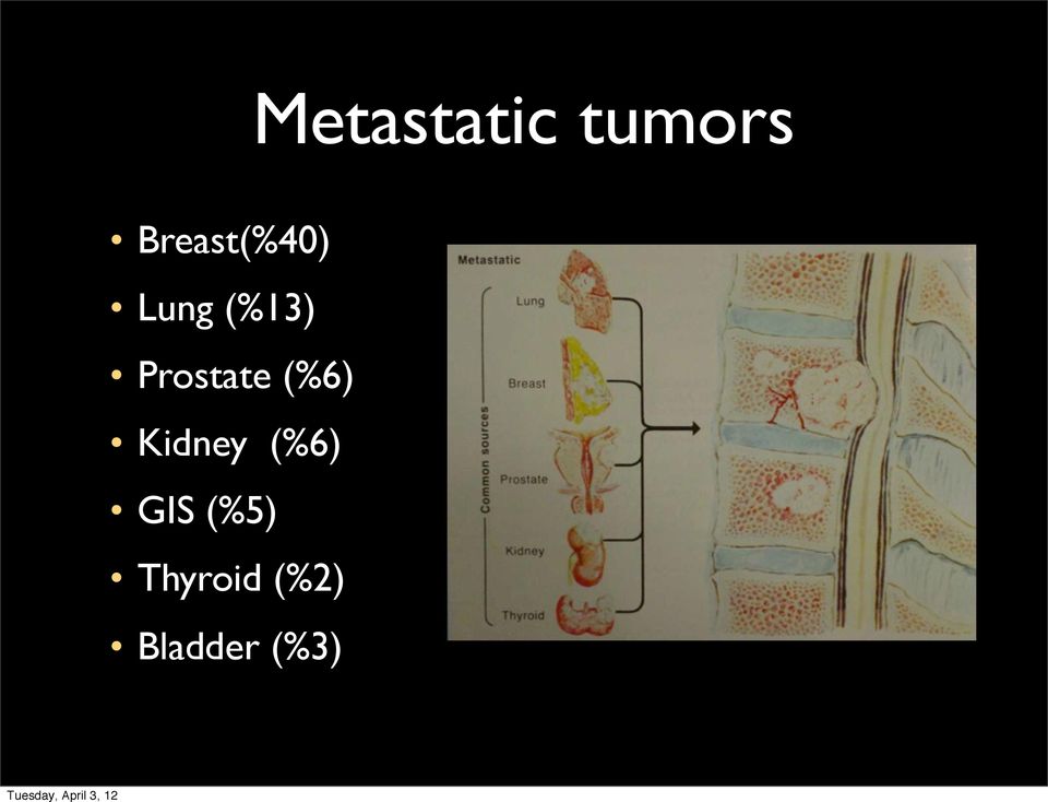 Prostate (%6) Kidney (%6)