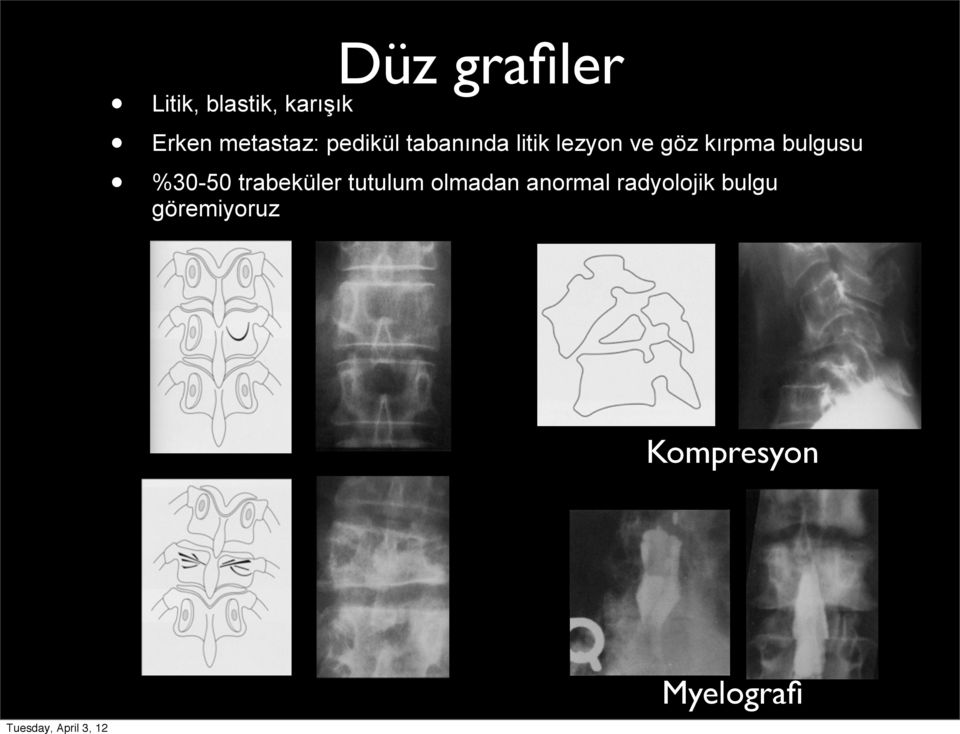 kırpma bulgusu %30-50 trabeküler tutulum olmadan