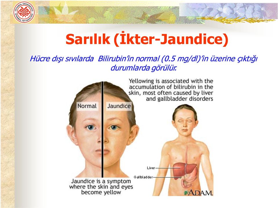 Bilirubin in normal (0.